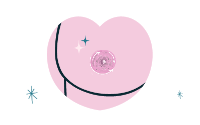 prestation cicatrices péri-aréolaires